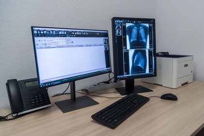 Как диагностировать туберкулез на ранней стадии и не попасться на удочку стереотипов: интервью с завотделением лучевой диагностики