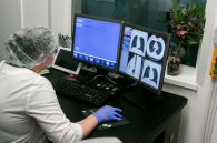 Смертность от туберкулёза в Новосибирской области уменьшилась на 36 процентов