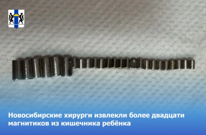 Новосибирские хирурги провели операцию по извлечению более двадцати магнитов из кишечника ребёнка.