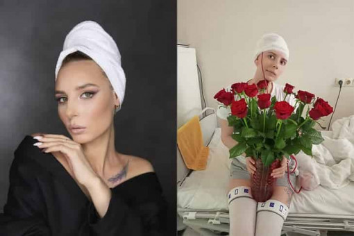 «Снова будет красивая девушка»: в Новосибирске нейрохирурги спасли пациентку, упавшую с самоката