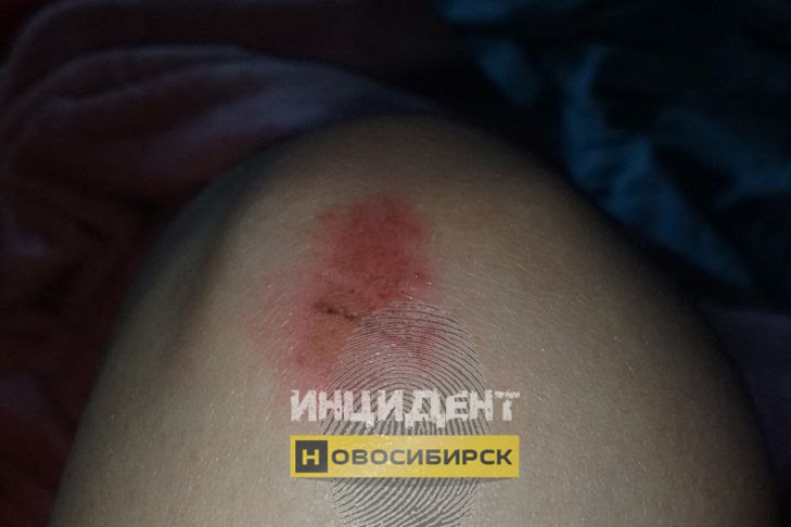 Тянул за грудь: неадекват набросился на 16-летнюю девушку в Новосибирске