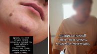 Женщина напала на новосибирскую зоозащитницу после изъятия 60 кошек