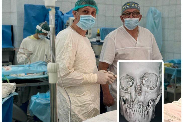 Девочка без носа родилась в Новосибирской области