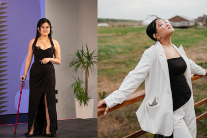 Жительница Новосибирска с редким заболеванием научилась бороться за жизнь