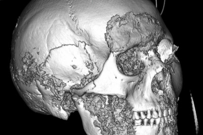 Череп женщины пазырыкской культуры обследовали ученые НГУ на томографе