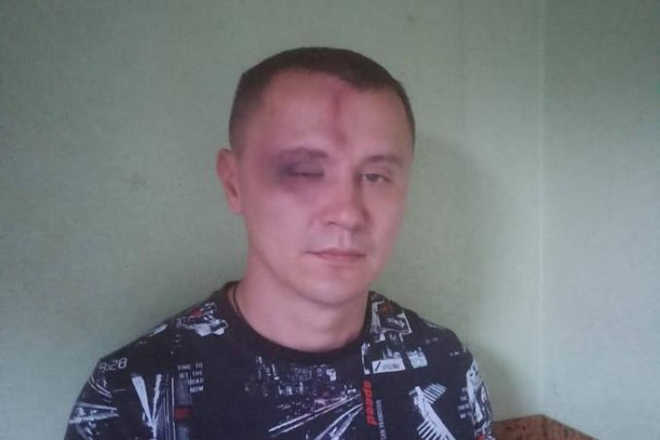  Избили дружинника у ГУМа: полиция начала проверку