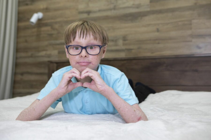 Русфонд собирает средства на приобретение мазей и кремов для ребенка с ихтиозом