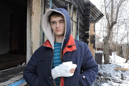 Подросток голыми руками ломал стекло, чтобы спасти соседей
