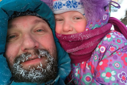 Нечувствительность кожи лица к холоду объяснила доктор Козырева в Новосибирске