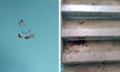 Кровь в подъезде и разбитые стекла: дебоширы атаковали новосибирцев