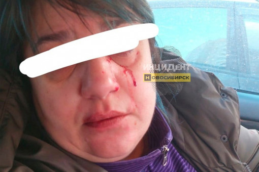 Мать и дочь избили женщину за неправильную парковку в Новосибирске